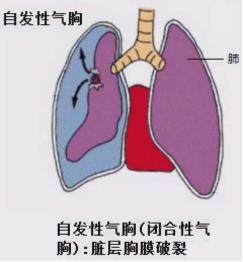 11eb7b8be35644c5a07aeab2b1015ece.jpg 11eb7b8be35644c5a07aeab2b1015ece.jpg